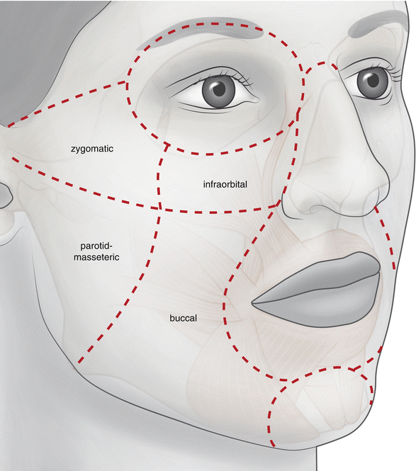 Vestibule and Cheeks SpringerLink
