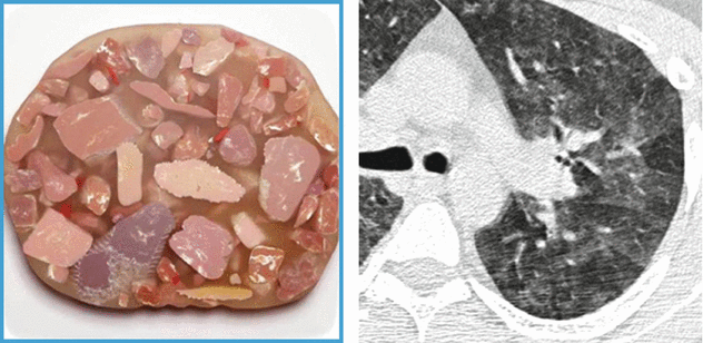 Case Based Glossary With Tips And Tricks Springerlink