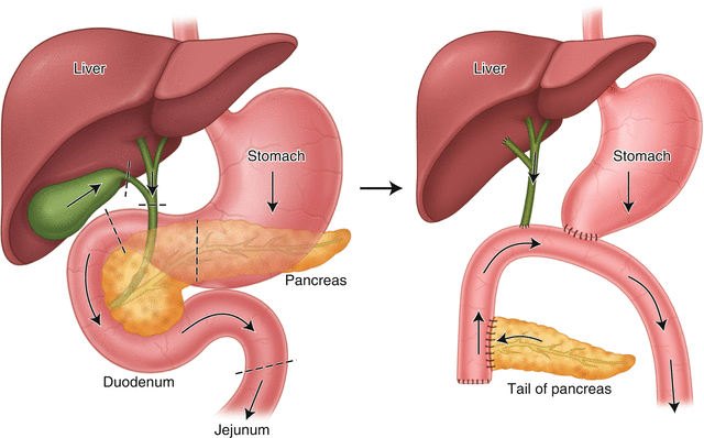 General And Emergency Surgery Springerlink