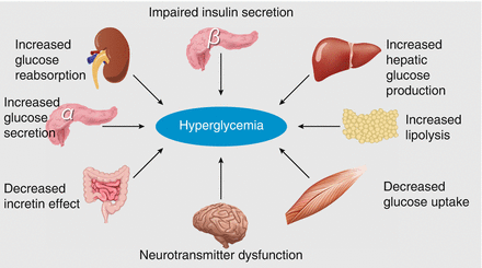 Overview of Type 2 Diabetes | SpringerLink