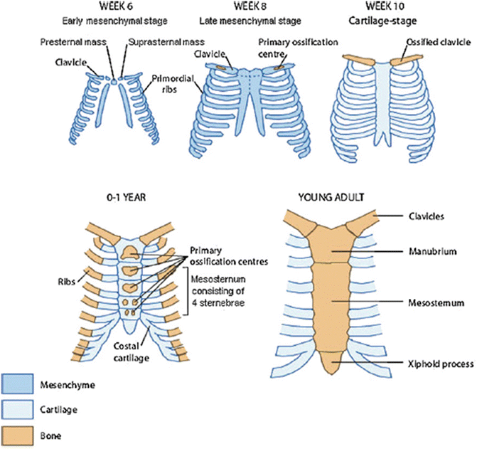 Sternal Clefts and Anomalies | SpringerLink