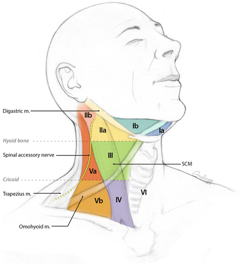 Normal Cervical Lymph Node Appearance and Anatomic ... neck lymph node levels diagram 