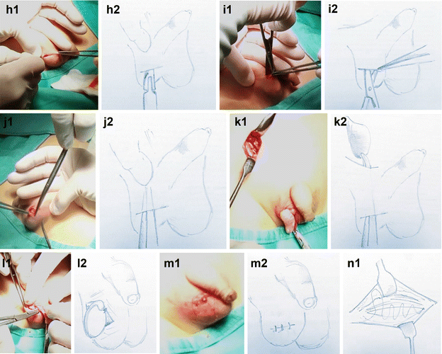 Testis Development and Descent | SpringerLink Testis Development and Descent | SpringerLink