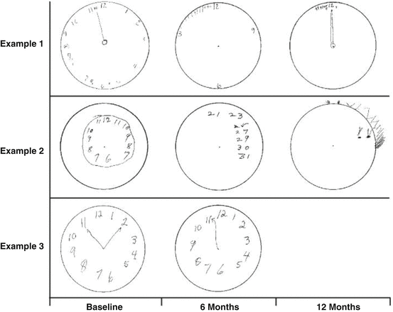 Clock Drawing Test Springerlink