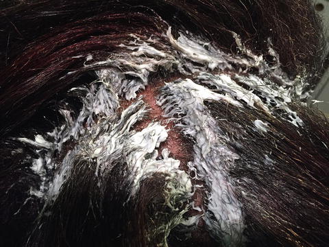 Chemical Modifications Of Ethnic Hair Springerlink Chemical Modifications Of Ethnic Hair Springerlink