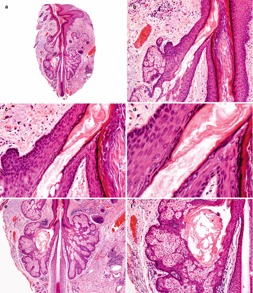 Embryology Anatomy Histology And Physiology Of The Sebaceous Glands Springerlink
