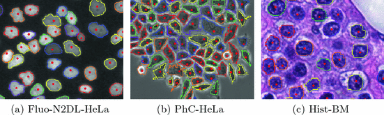 deep learning cell segmentation