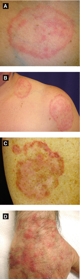 Infectious Diseases Springerlink