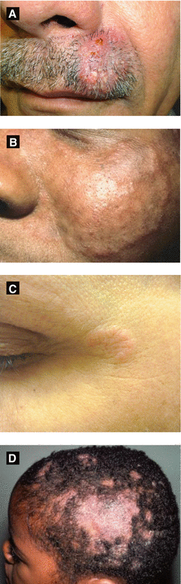 Infectious Diseases Springerlink
