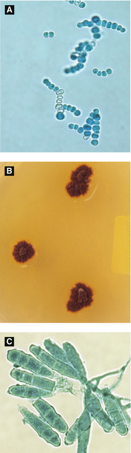 Infectious Diseases Springerlink