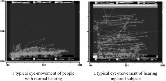 Speech Recognition Systems For The Hearing Impaired And The - 