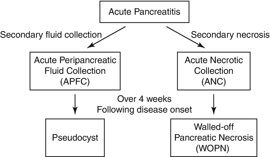 Computerized Tomography In The Diagnosis And Treatment Of Acute Pancreatitis Springerlink