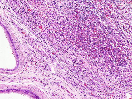 Reactive Pathology of the Epididymis | SpringerLink