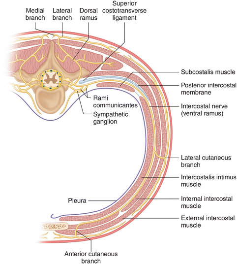 complications of thoracic wall regional anesthesia and analgesia pec block