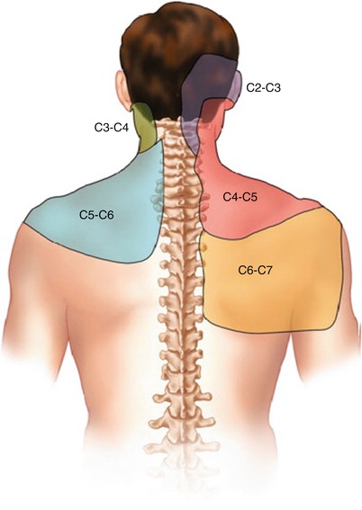 Facet-Mediated Pain | SpringerLink