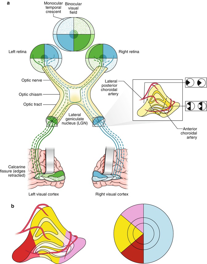 Types of Homonymous Visual Field Defects | SpringerLink