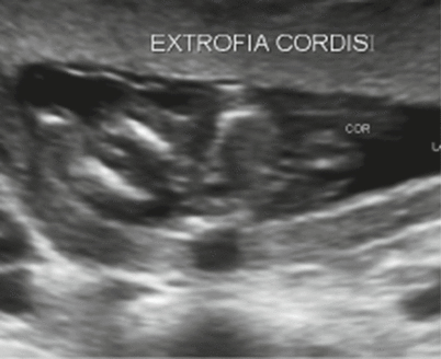 The Fetal Abdomen Springerlink