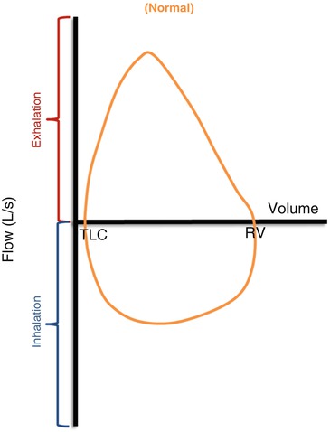 flow volume loops springerlink flow volume loop