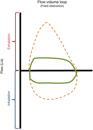 flow volume loops springerlink flow volume loop