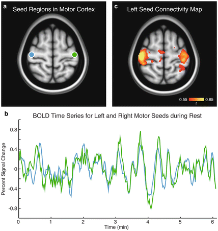 Resting State Functional Connectivity Mri Fcmri Springerlink