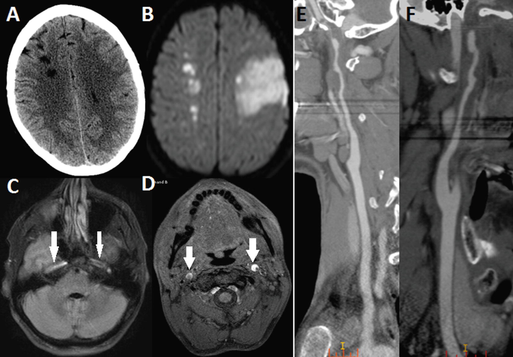 Traumatic Brain Injury Imaging Strategy Springerlink