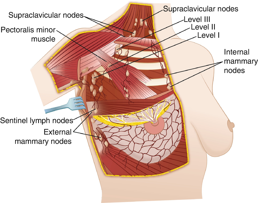Oncoplastic And Reconstructive Anatomy Of The Breast Springerlink