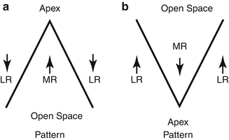 A Pattern V Pattern And Other Alphabet Pattern Strabismus