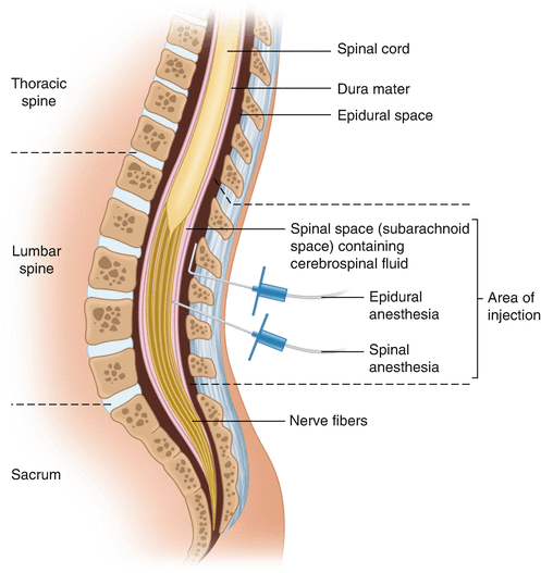 Mechanisms of Labor Analgesia | SpringerLink