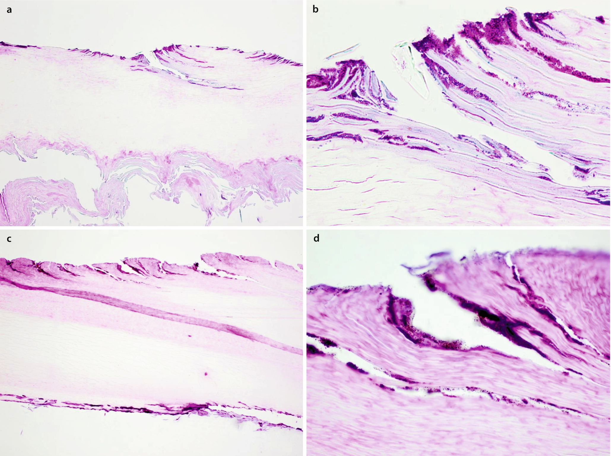 Normal Nail Anatomy, Normal Nail Histology, and Common Reaction ...