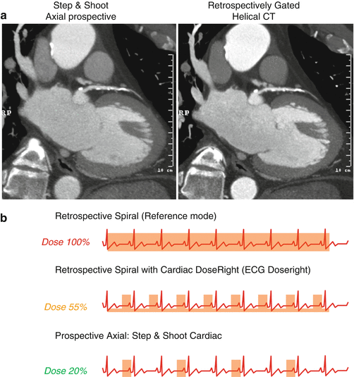 innovations in cardiac cta springerlink