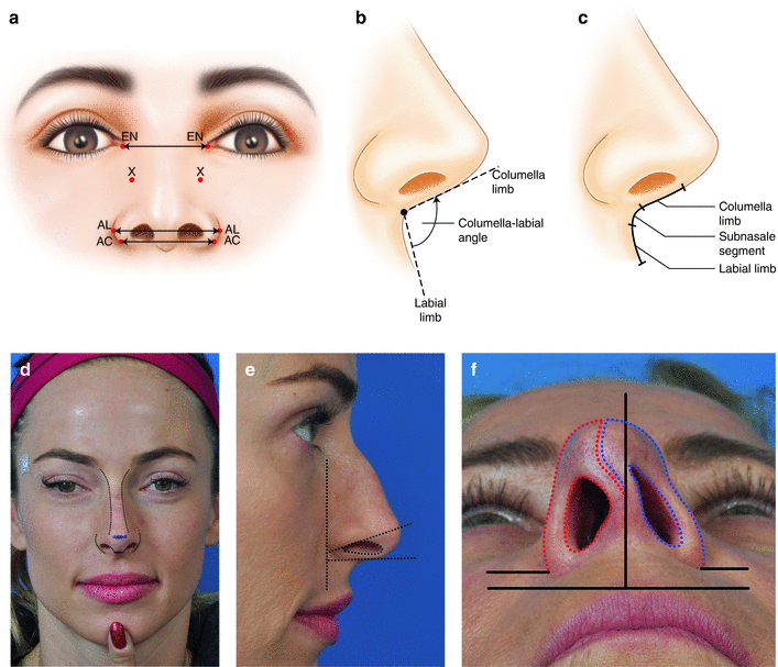 Nasal Base | SpringerLink