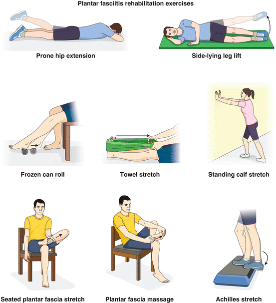 Лечебная гимнастика при плантарном фасциите. Какие упражнения при шпоре. Лечебная гимнастика при плантарном фасциите. Нельзя ли найти у вас про шпоры что нибудь. Плантарный фасциит стопы лечебная гимнастика.