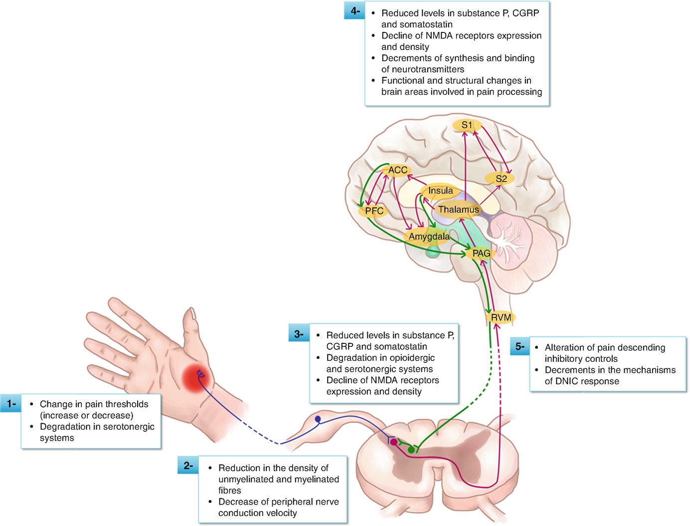 Pathophysiology of Pain | SpringerLink