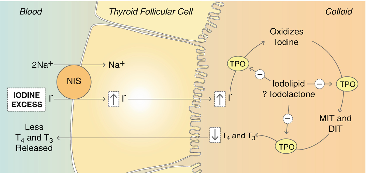 Iodine Induced Thyroid Dysfunction Springerlink
