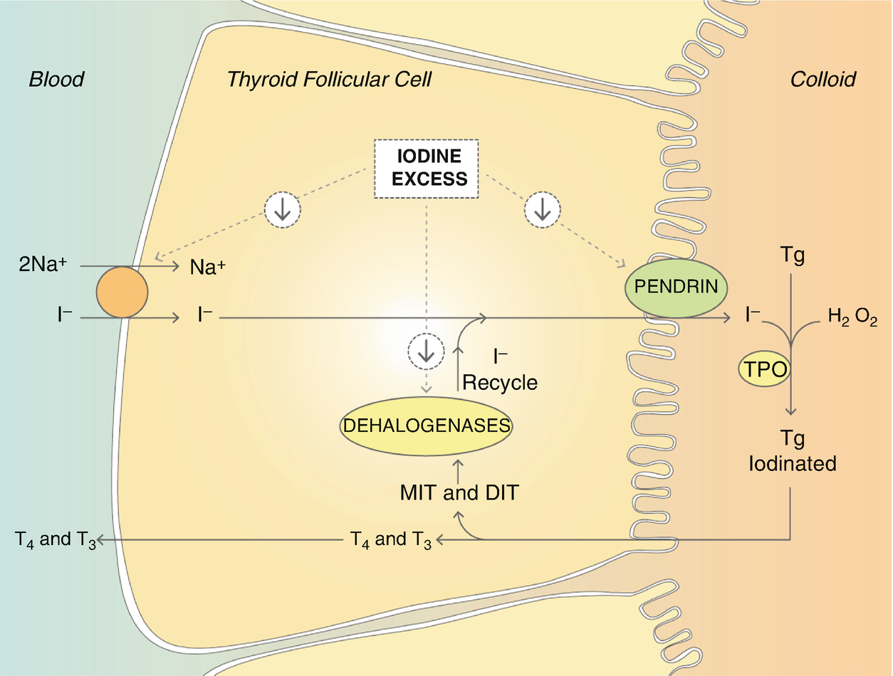 Iodine Induced Thyroid Dysfunction Springerlink