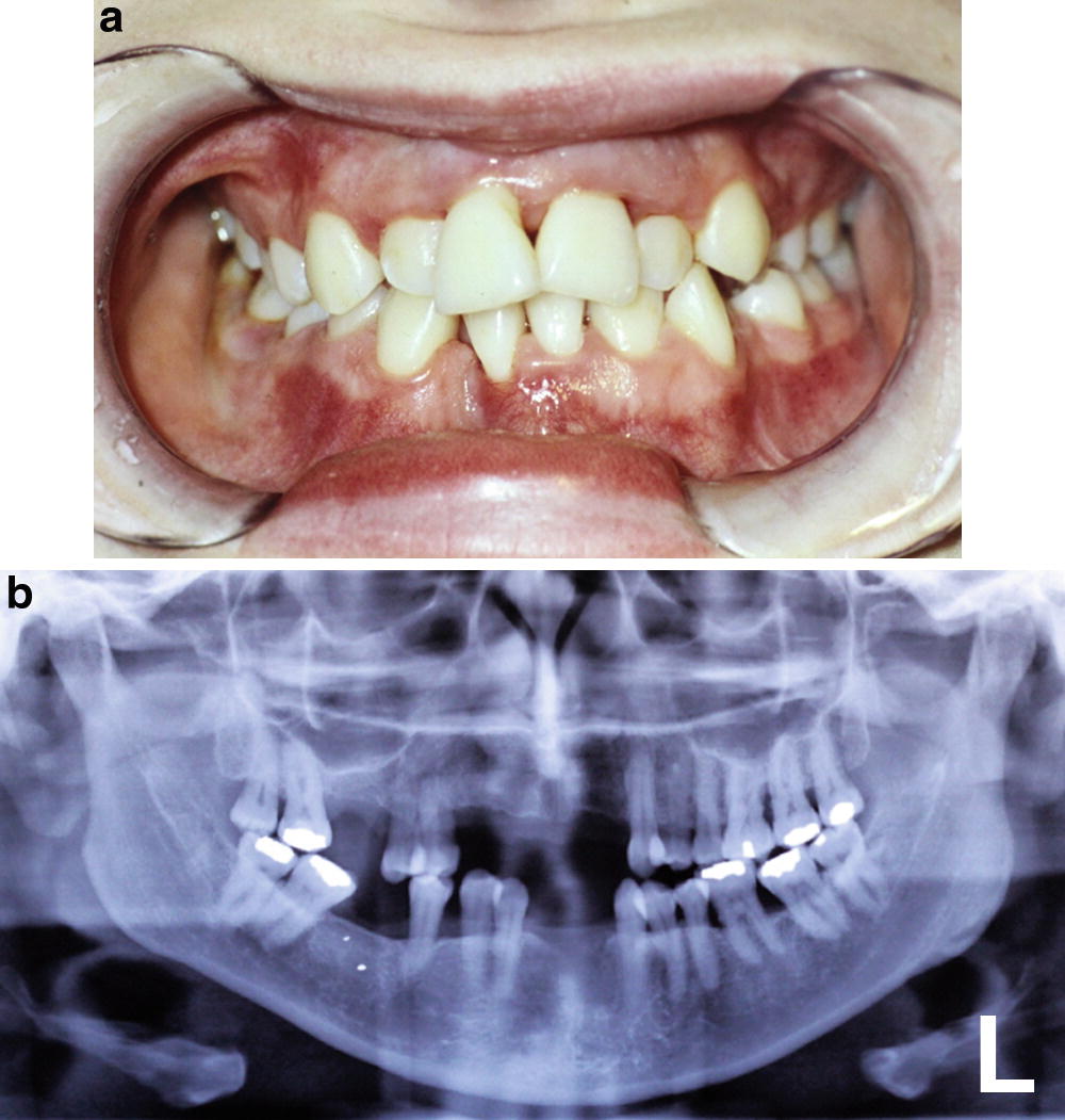 Pediatric Oral Medicine Springerlink
