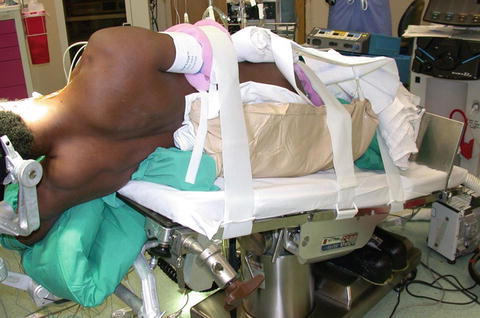 Intracranial Procedures In The Lateral Position Springerlink