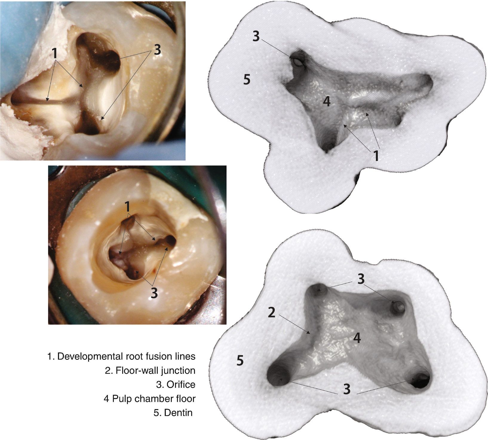 3d Visual Glossary Of Terminology In Root And Root Canal Anatomy