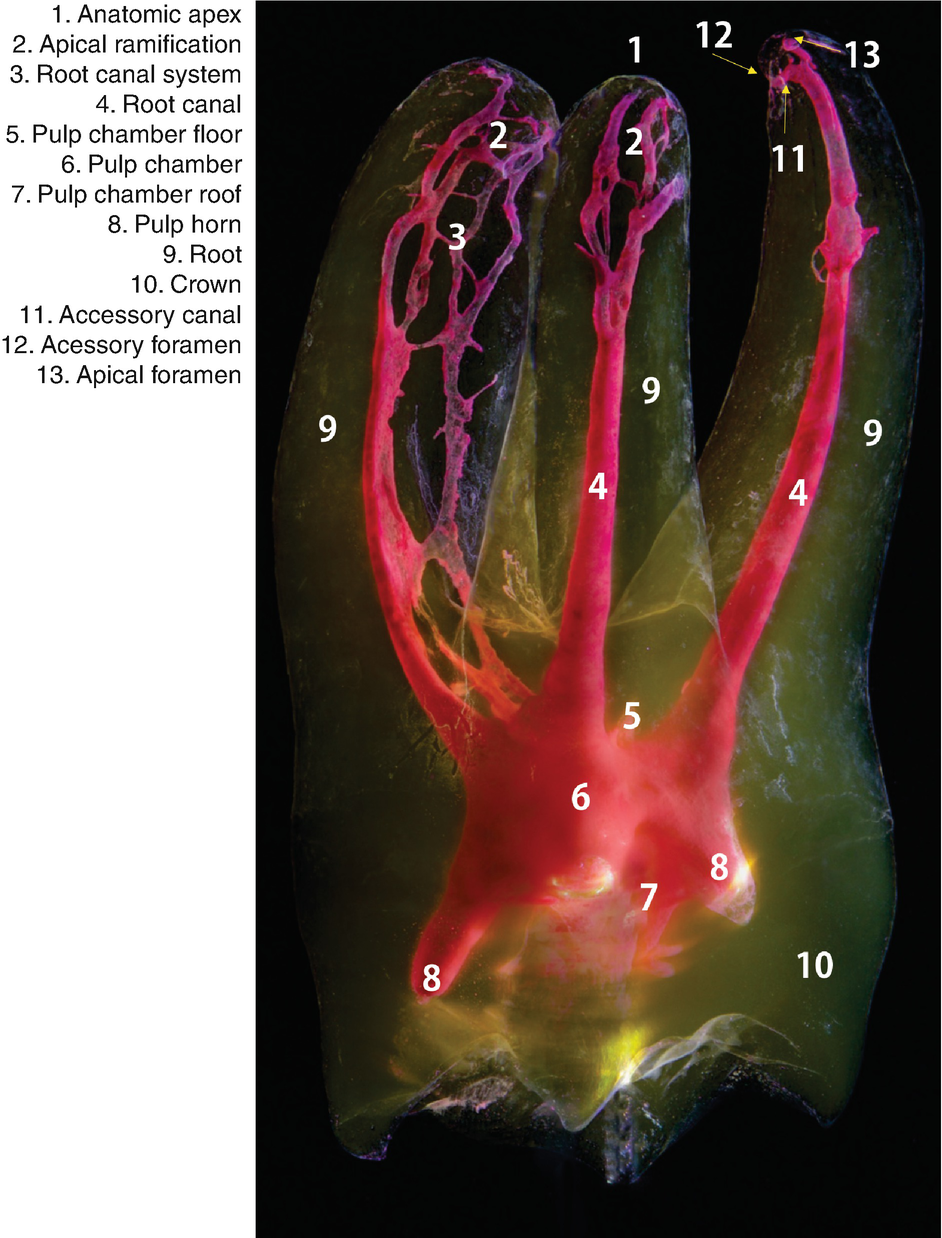 3d Visual Glossary Of Terminology In Root And Root Canal Anatomy