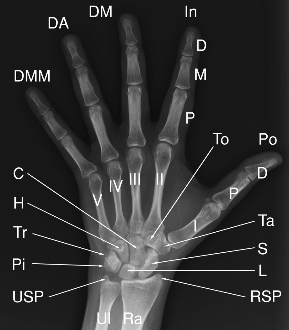 Imaging Anatomy Conventional Radiography Springerlink