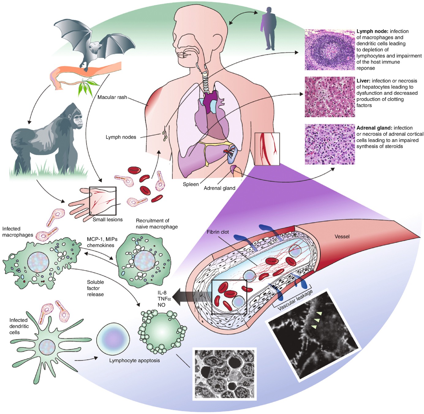 Ebola Virus Springerlink