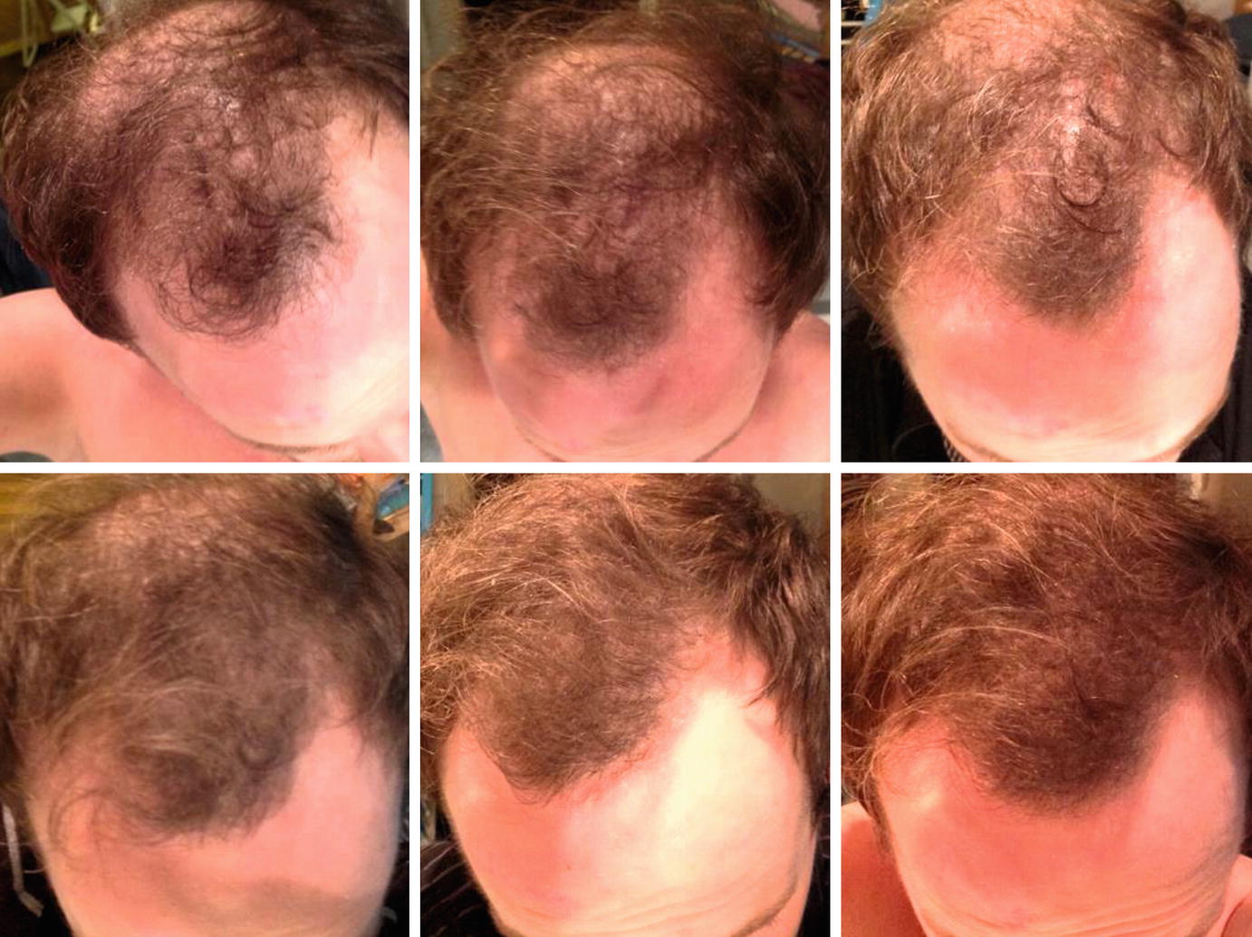 Fundamentals Springerlink