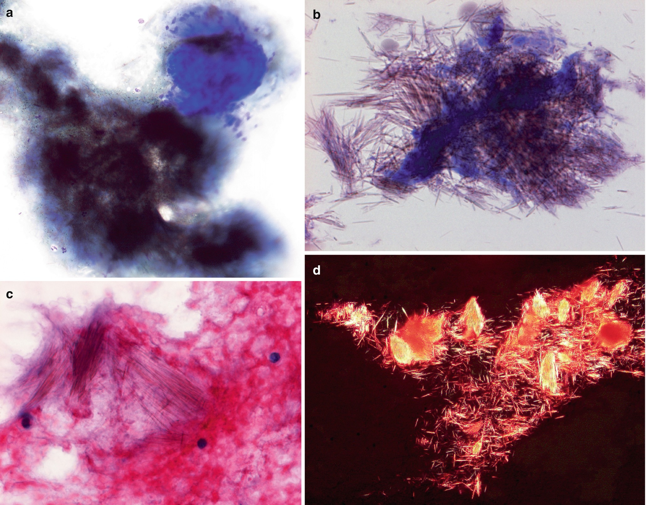 Soft Tissue Springerlink