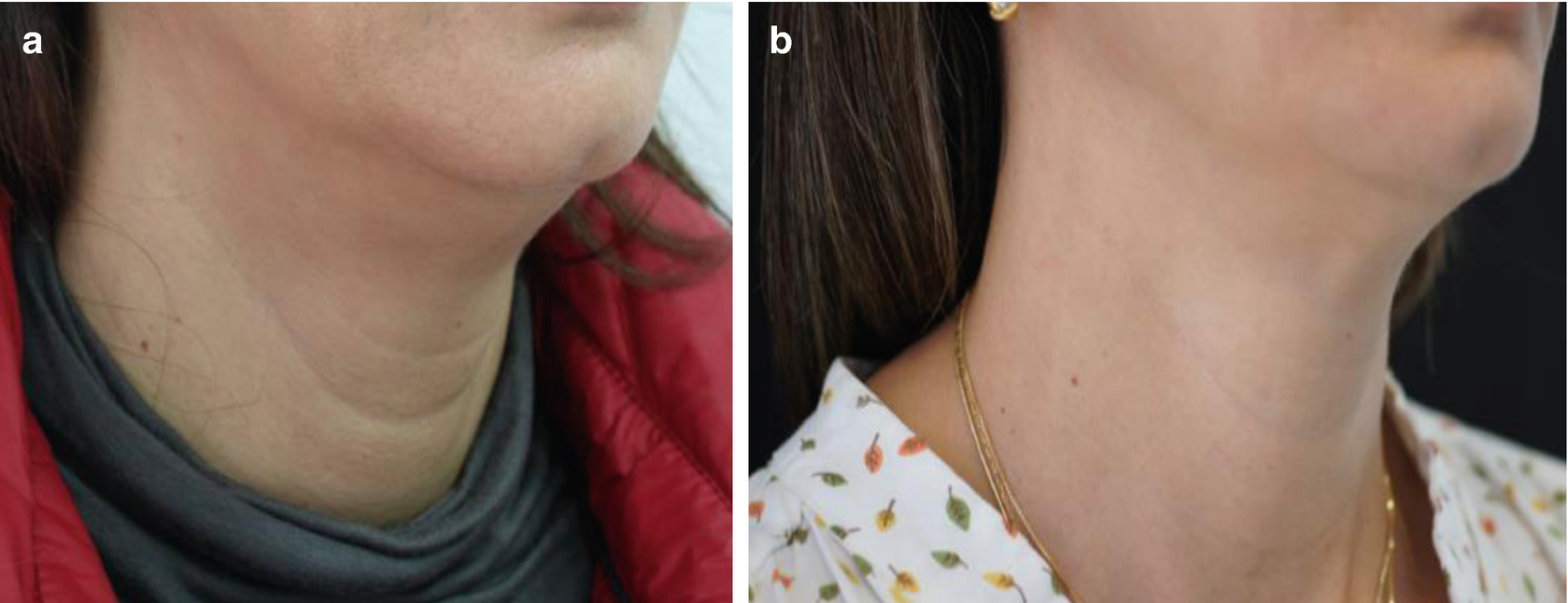 spf 50 face cream moisturizer