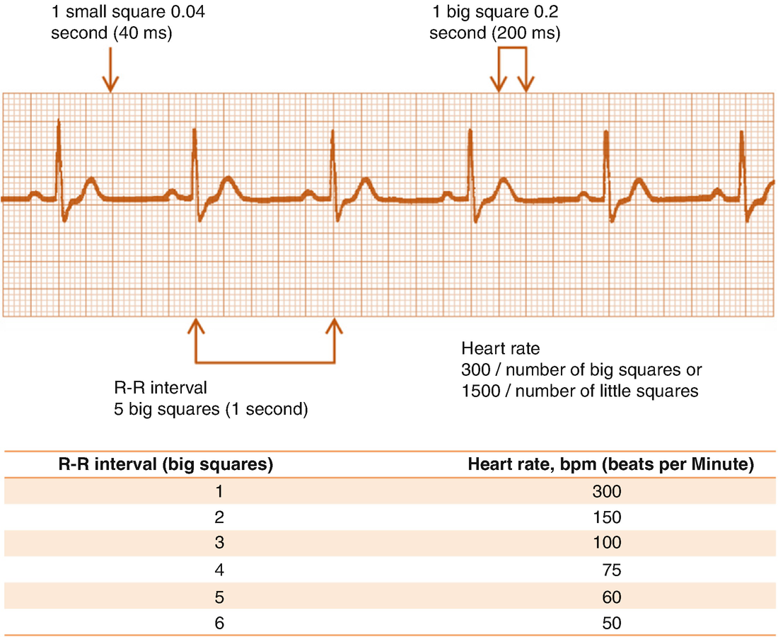 Fundamentals Of Ecg Springerlink