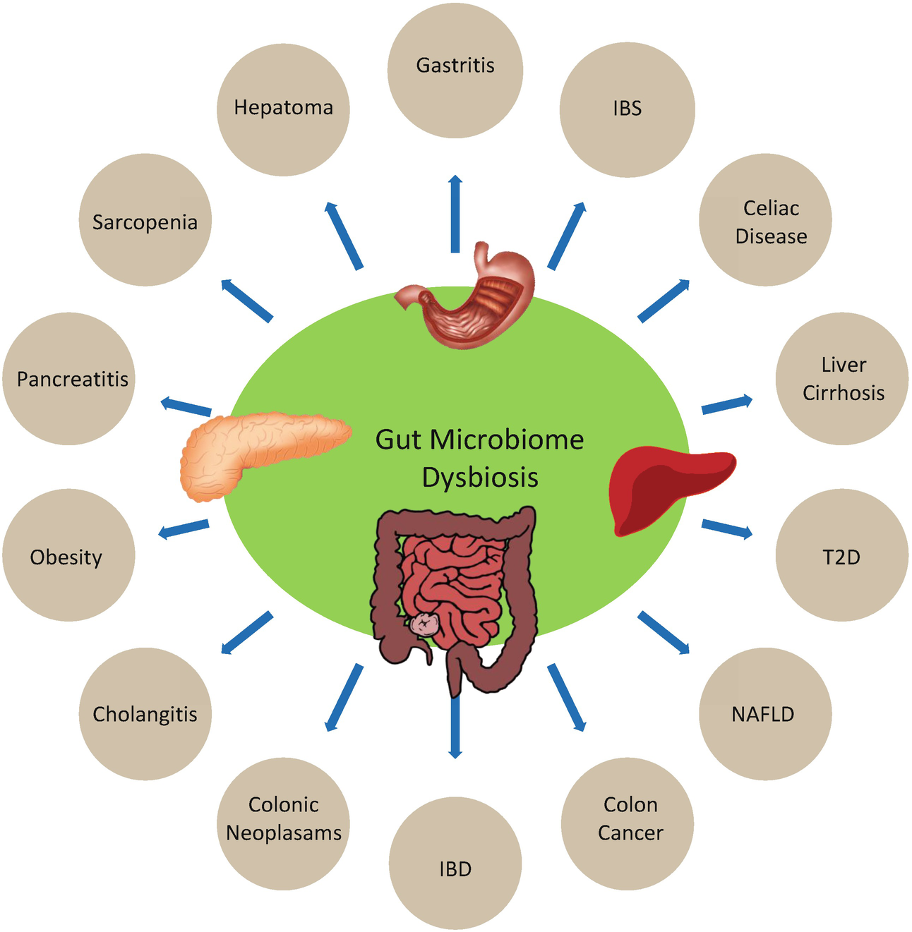 dysbiosis gastritis)