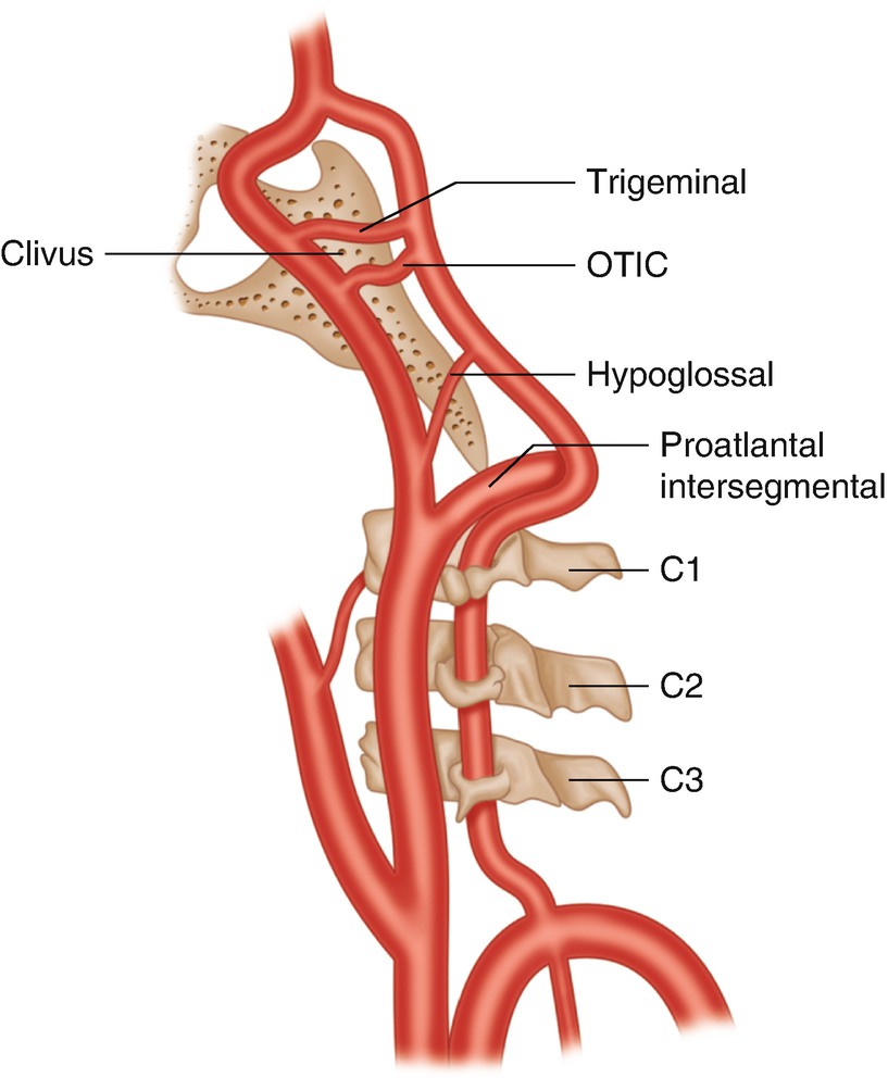 Surgical Anatomy Of Carotid And Vertebral Arteries Springerlink