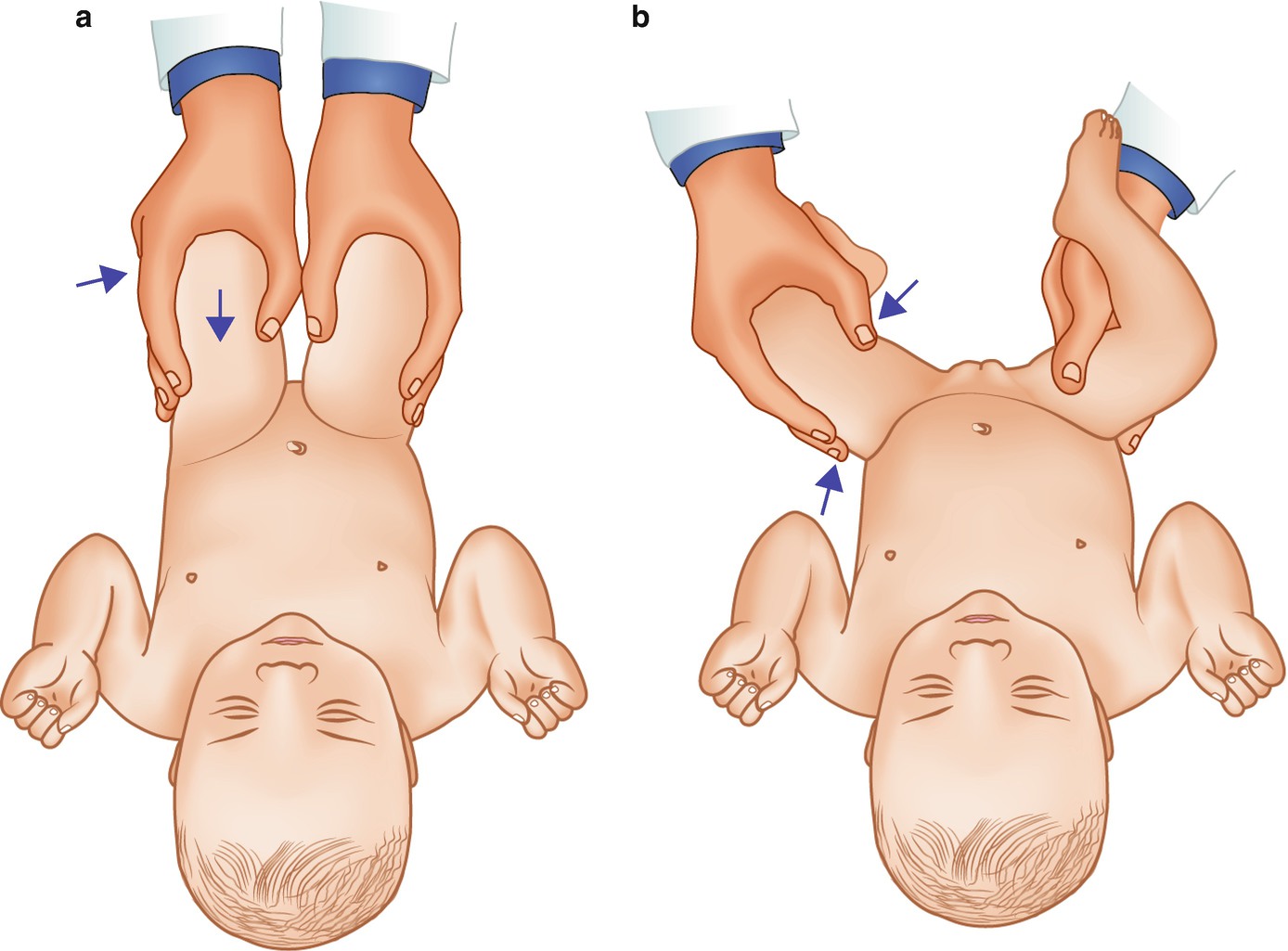 Examination Of The Newborn Springerlink