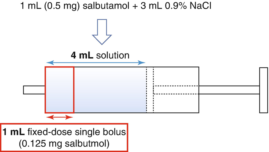 How To Induce Arrhythmias With Salbutamol Springerlink