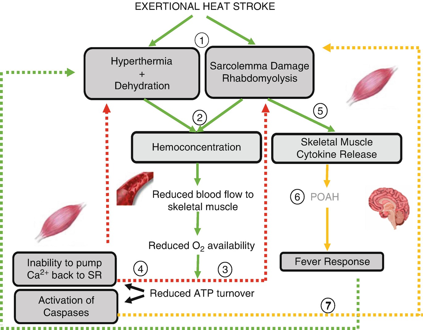 Common Misconceptions in Classic and Exertional Heat Stroke | SpringerLink Common Misconceptions in Classic and Exertional Heat Stroke | SpringerLink